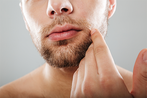 Greffe de barbe Tunisie